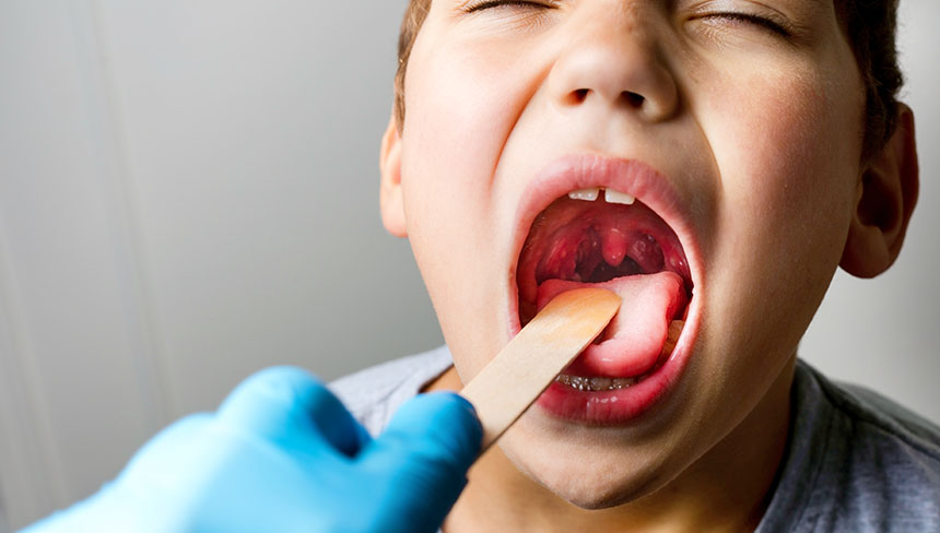 patient needing tonsillitis treatment in Campbell
